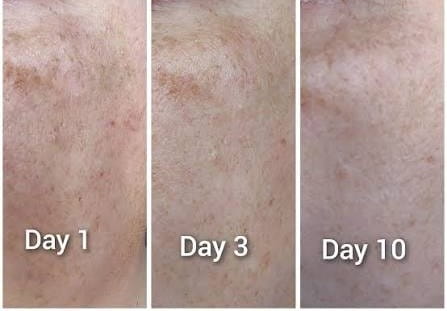GaiaCliniques Vitamin C Face Serum for Dark Spots - 30ml