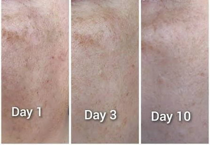 GaiaCliniques Vitamin C Face Serum for Dark Spots - 30ml