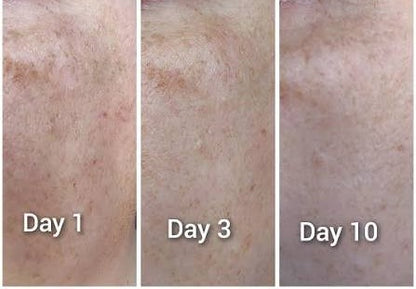 Advanced Clinical Vitamin C Max Brightener Serum